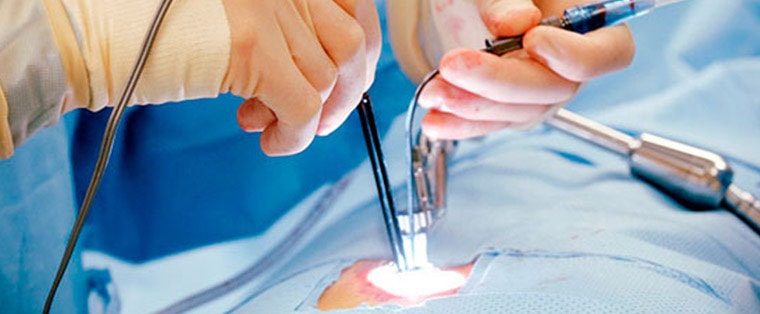Minimally Invasive Cardiac Surgery Minimally Invasive Cardiac Surgery